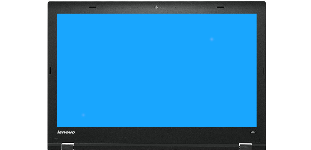 Lenovo Thinkpad L440 Pantalla Puntos Blancos